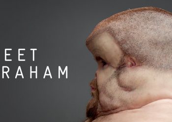 حملة إعلامية: التوعية بحوادث المركبات